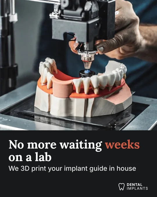 Sample ad for a dental implant practice: a 3D printer making an implant guide on a model of a jaw. Headline: No more waiting weeks on a lab. Below it: We 3D print your implant guide in house.